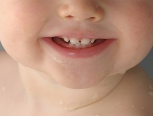 عوارض باقی ماندن دندان شیری