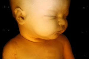 سونوگرافی سه بعدی خطری برای جنین ندارد
