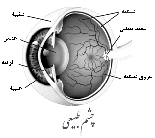 عوارض چشمی فشار خون