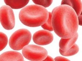 درمان  کم خونی  ناشی از فقر آهن یا کم بودن هموگلوبین خون