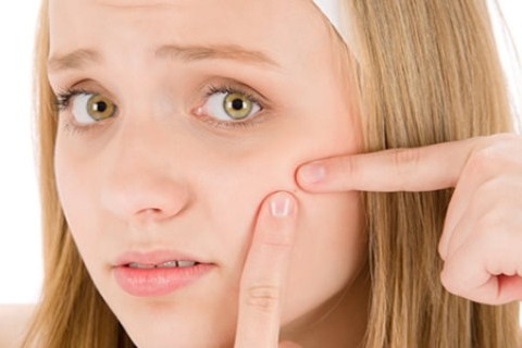 ۱۲ روش برای مقابله با جوش صورت
