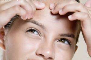 4 درمان عالی برای از بین بردن جوش صورت