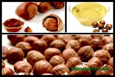 درمان و جلوگیری از پیشرفت واریس