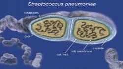پنوموکوک چیست؟