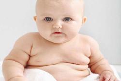 افزایش خطر چاقی در کودکان سزارینی