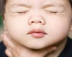 پریدن جسم خارجی در گلوی کودک