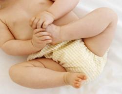 سوختگی پای نوزاد