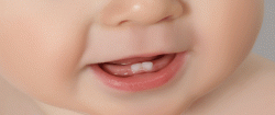 اولین دندان کودک چه زمانی می روید؟