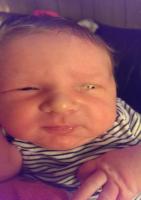 چسبندگی چشم نوزاد بعد از تولد