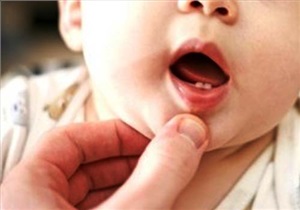 شش ماهگی اولین دندان نوزاد جوانه میزند