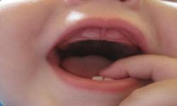 آیا دندان‌های شیری مهم‌اند؟