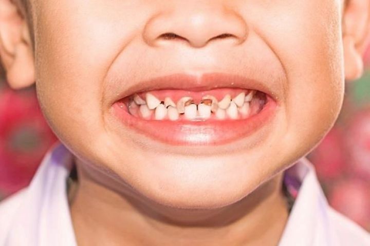 معاینه دندان کودک بصورت منظم